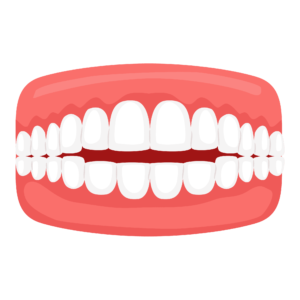 Dental Misalignment issues - Openbite - clearalignerinkerala.com