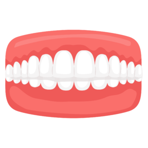 Dental Misalignment Issue - Overbite - clearalignerinkerala.com
