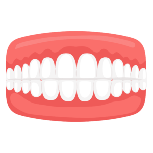 Dental Misalignment Issues - Underbite - clearalignerinkerala.com