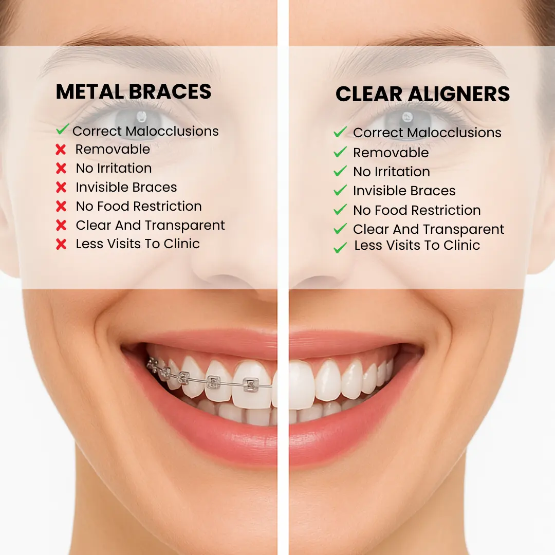 Comparison image between Clear aligner and Metal braces.
