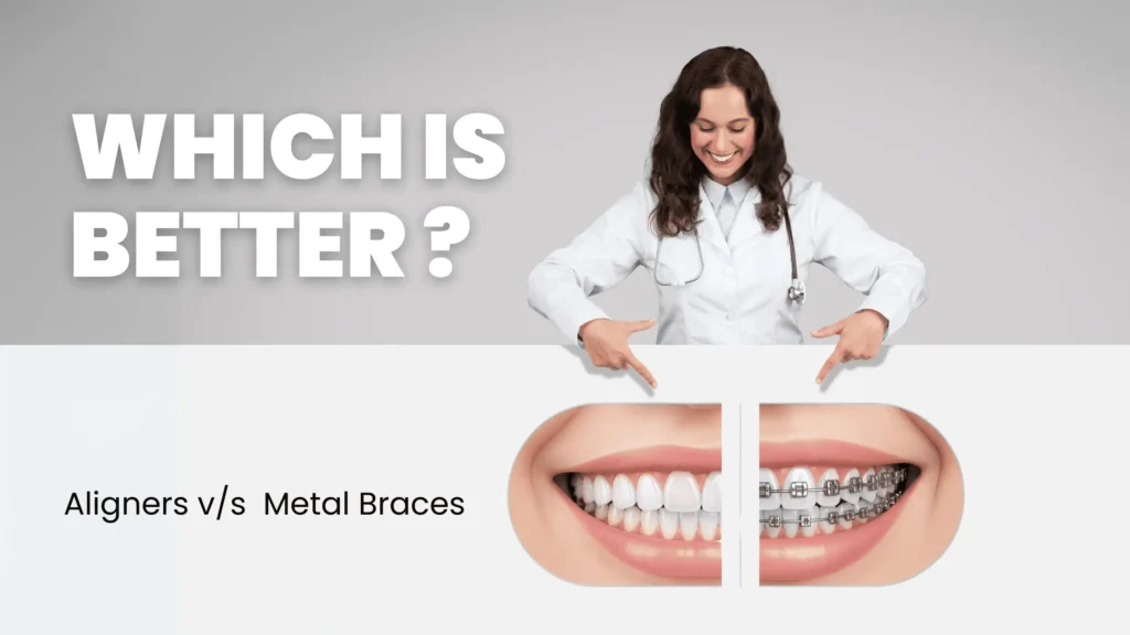 Clear aligners vs braces - Comparison image of clear aligner and metal braces.