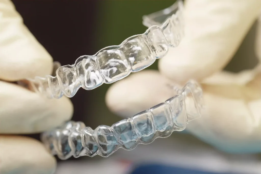 How Long Does Clear Aligner Treatment Take in Kerala