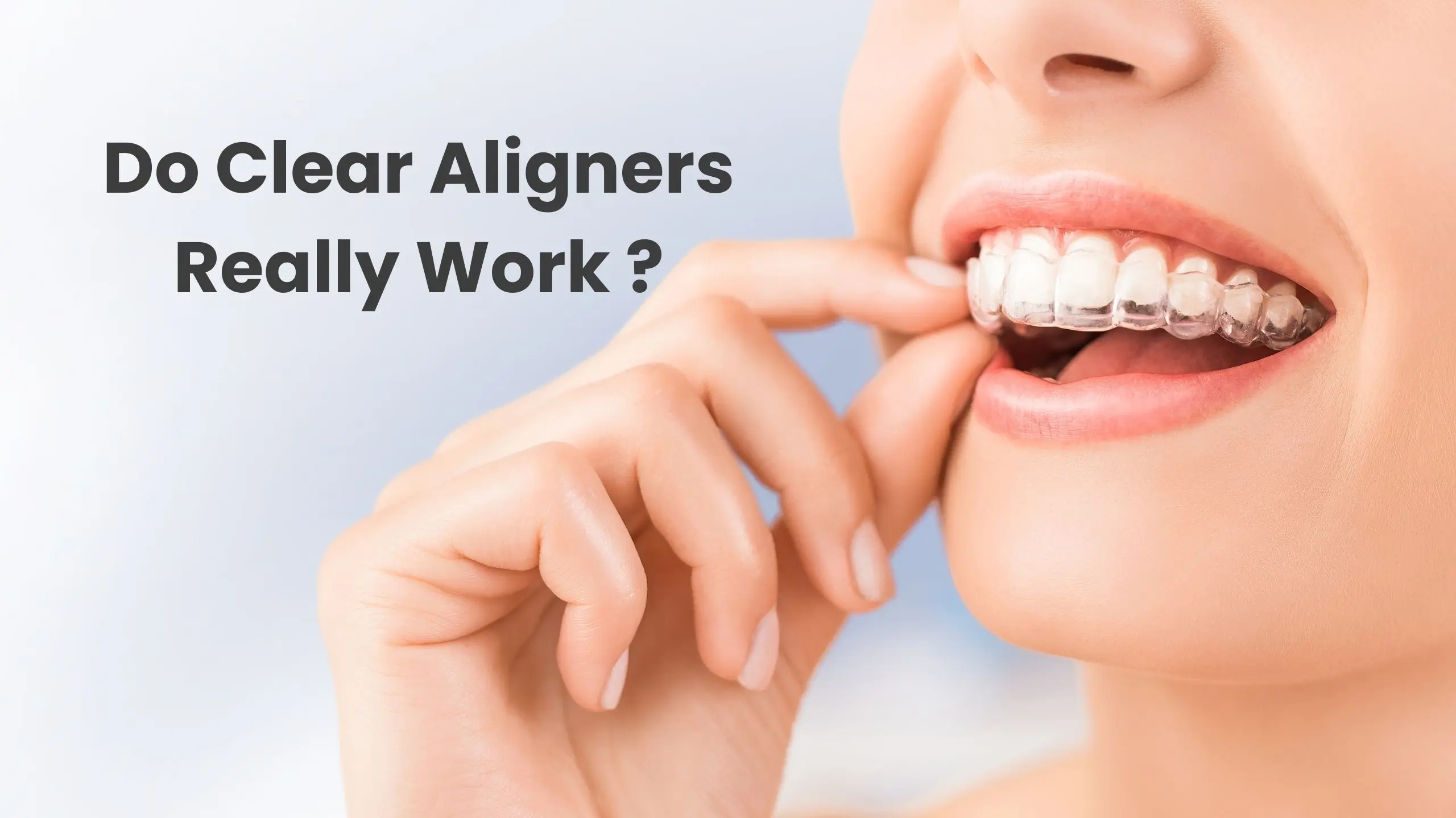 Do clear aligners really work