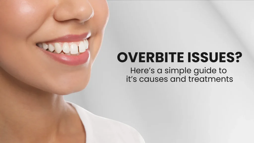 What Is an Overbite? A Simple Guide for Everyone
