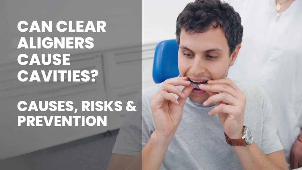 Can Clear Aligners Cause Cavities